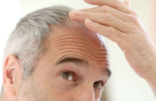 Aging Hair Loss treatment in Lahore Pakistan